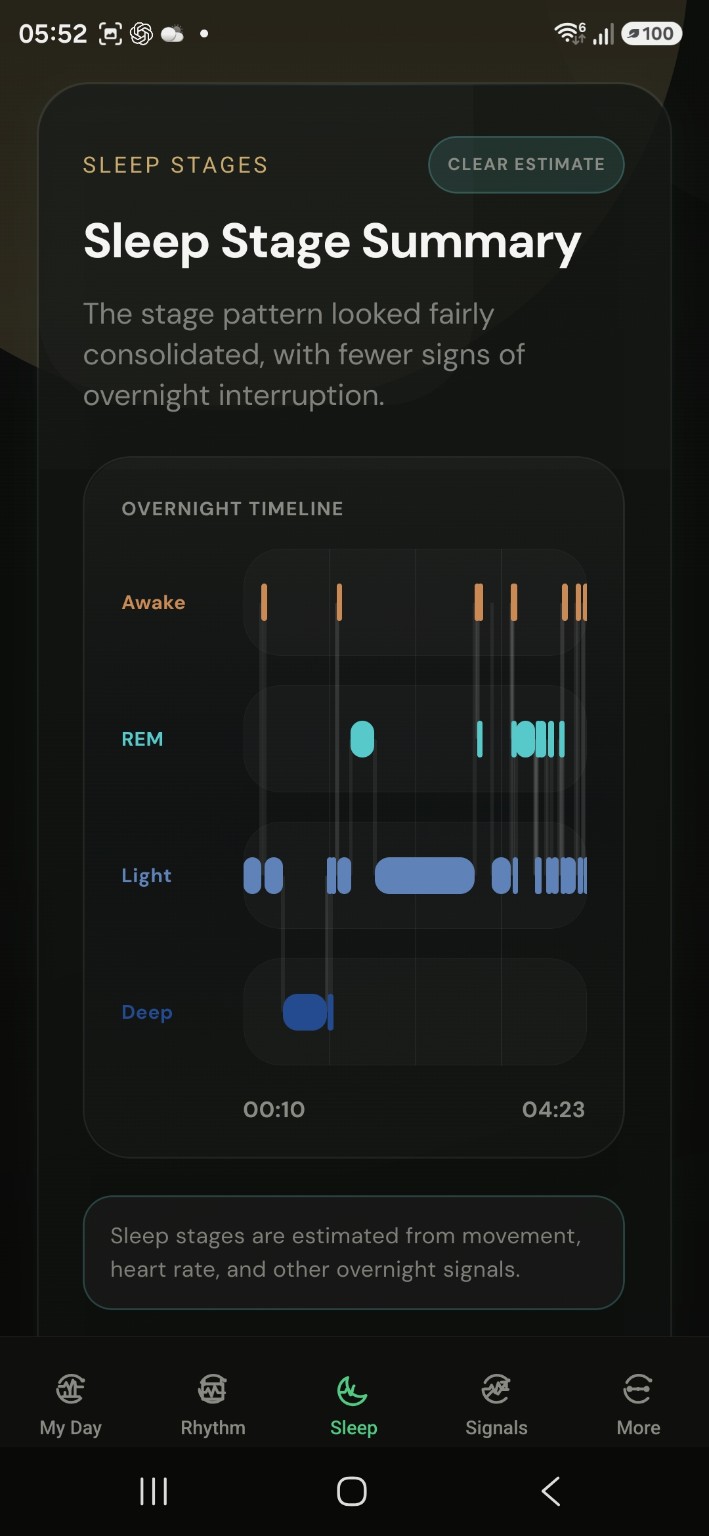 Vitalscope Wellness Sleep Stage Summary showing the overnight timeline